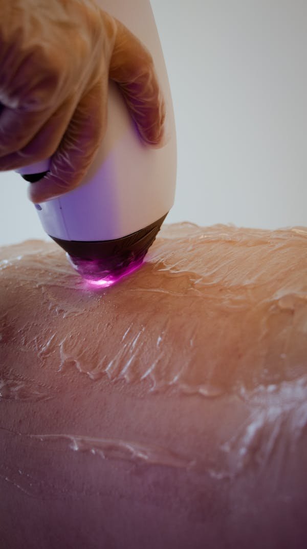 Les secrets des traitements laser au centre dermatologique à Lyon