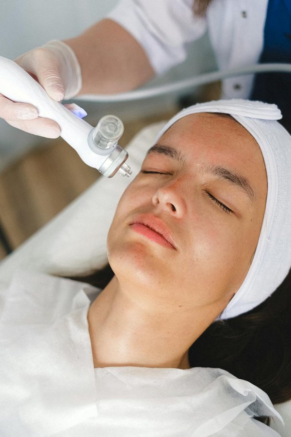 Top 5 avantages des traitements laser en dermatologie à lyon